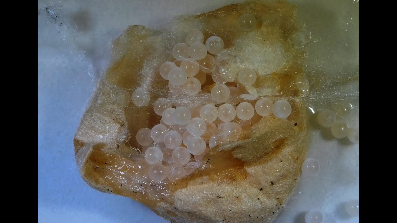 Let’s Look Inside a Black Widow Spider Egg Sac; Under a Video Microscope