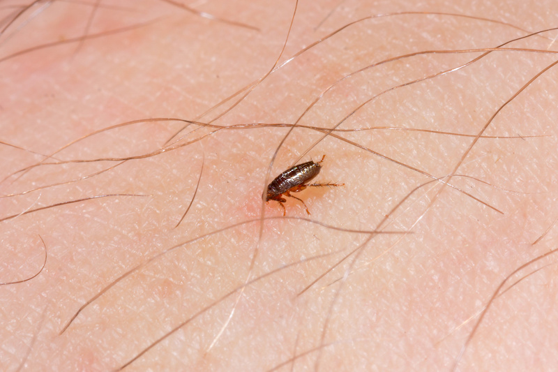 a little flea bites on a human